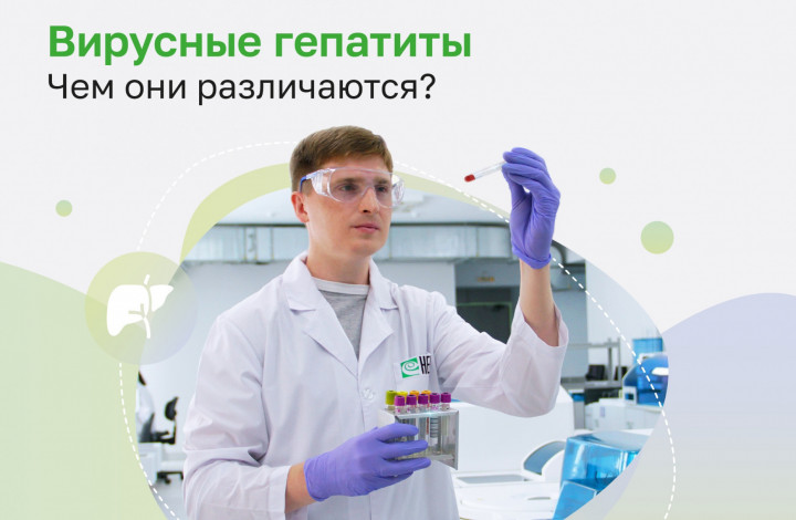 Вирусные гепатиты