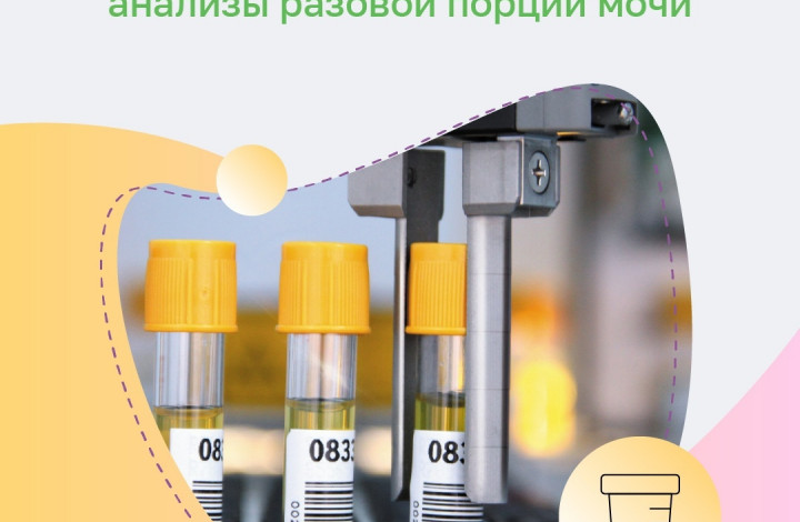 Подготовка к анализу мочи
