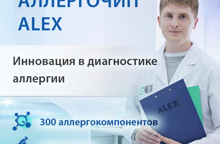 Анализ на аллергию